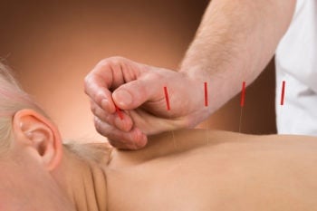 natural-treatment-for-ptsd-acupuncture