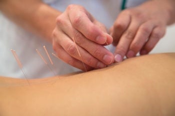degree-in-acupuncture