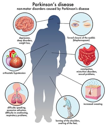 Parkinsons Symptoms